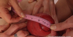 prolapse party rosebutt measure 14